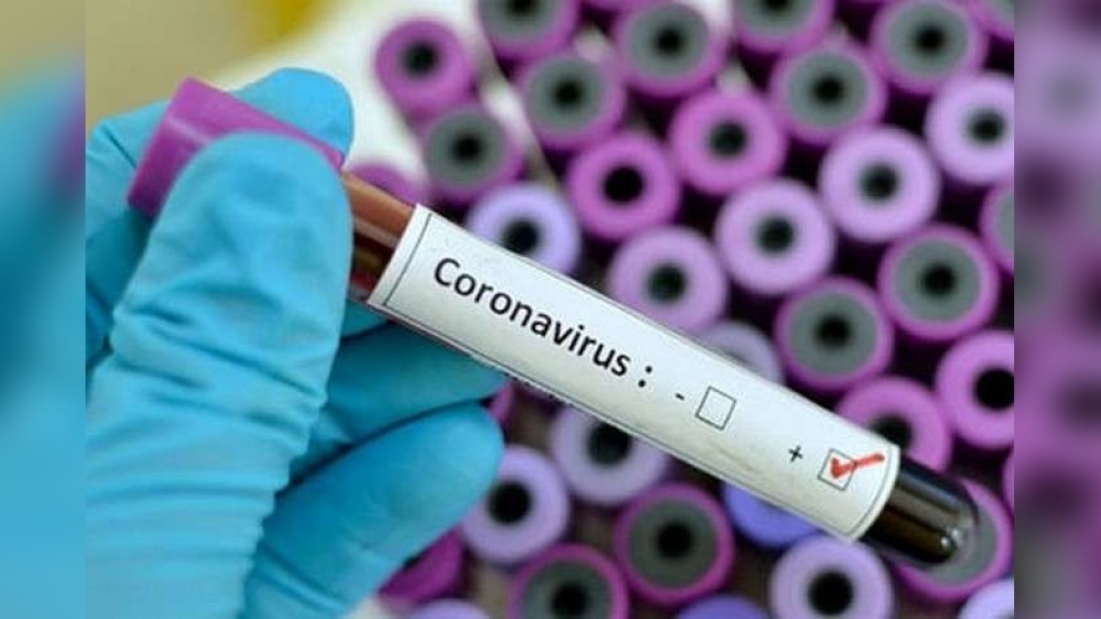 Azərbaycanda daha 67 nəfər koronavirusa yoluxub, 1 nəfər vəfat edib - 41 nəfər sağalıb