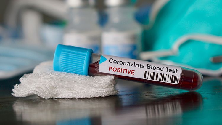 Koronavirus İrandan ərəb ölkələrinə yayıldı – Küveyt və Bəhreyndə epidemiya