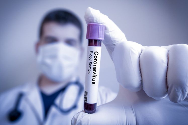 Türkiyədə bir gündə 214 nəfər koronavirusdan öldü