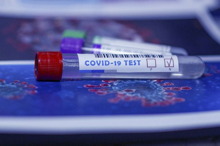 Milli Konservatoriyada koronavirus TƏHLÜKƏSİ - Dərslər dayandırıldı