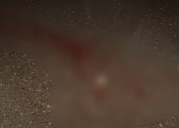 Kütləvi davada tələbəyə 5 xəncər zərbəsi vurdu