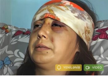 Bətnindəki körpənin cinsiyyəti qız olduğuna görə hamilə qadını döyərək uşağı tələf etdilər