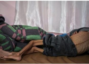 Qəzza xəstəxanalarında aclıq hökm sürür: Tibb bacıları huşunu itirirlər