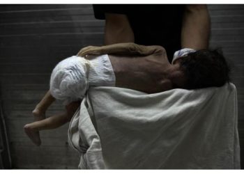 Qəzzanın körpələri acından ölür