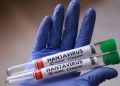 Çilidə dəhşətli dəhşətli virus yayılıb: Fövqəladə vəziyyət elan olundu