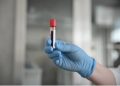 Lou: ABŞ Ukraynadakı bioloji laboratoriyaları maliyyələşdirir
